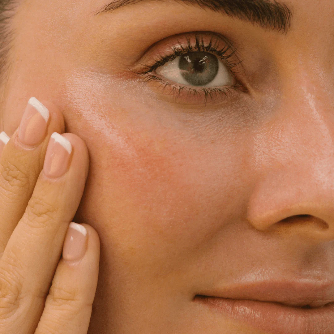 Clear Skin - Image 4